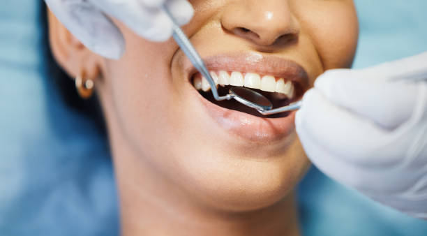 Best Tooth Infection Emergency Dentist  in University, MS